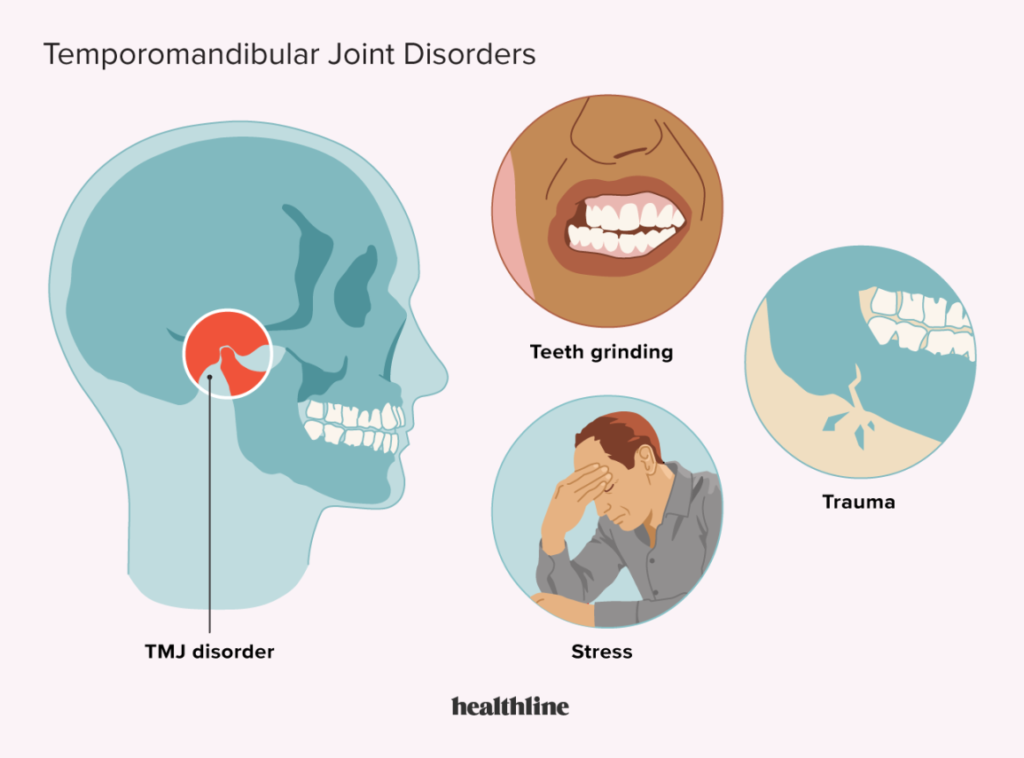 Trastornos de la ATM (articulación temporomandibular)